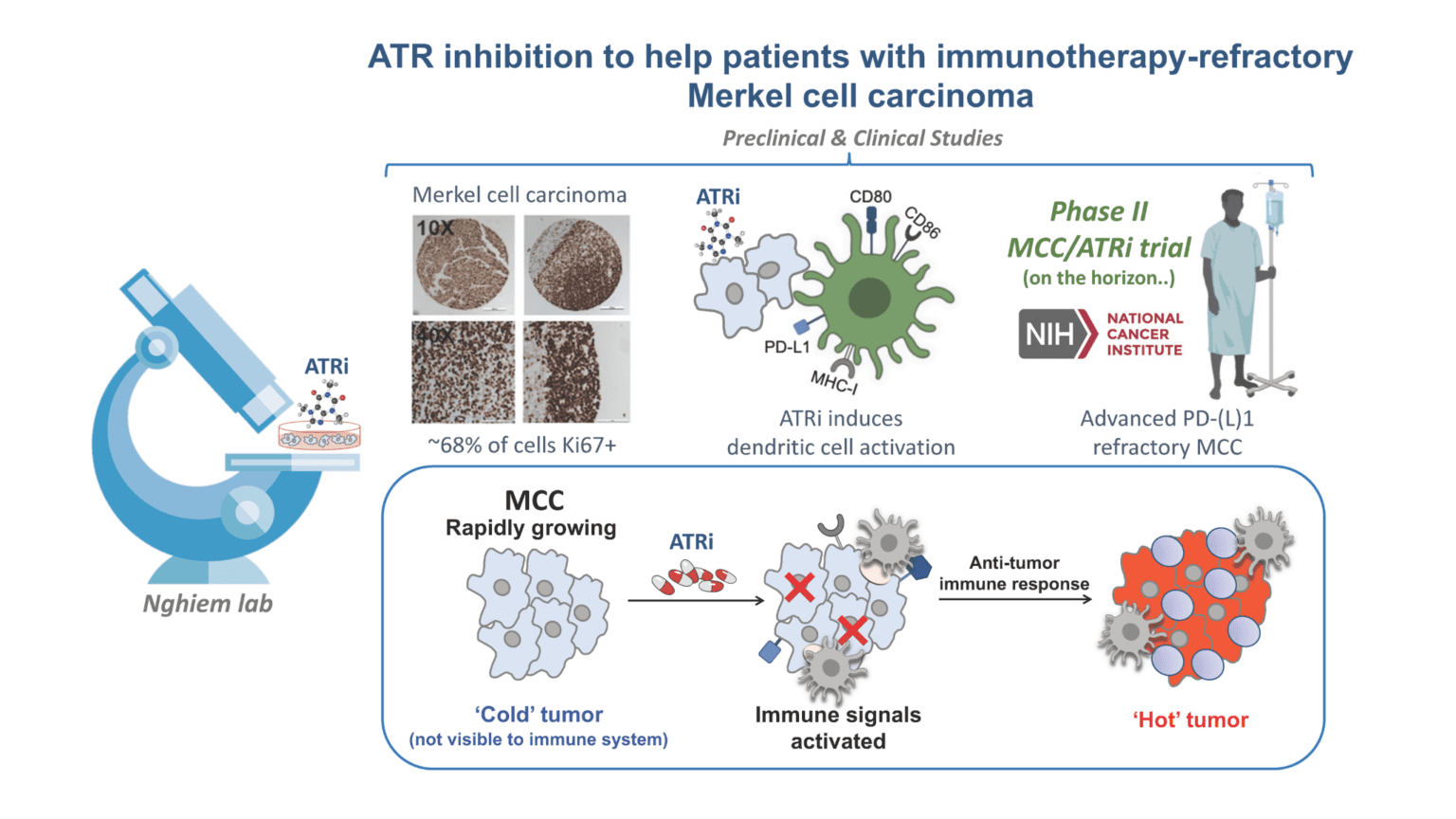 Schema of potential mechanism of action for enhanced immune response in PD-1 refractory MCC with an ATRi. (PMID: 34298632; abbreviations: ATRi: ATR inhibitor, CD80/86, MHC-I, PD-L1: immune activation markers, MCC: Merkel cell carcinoma)