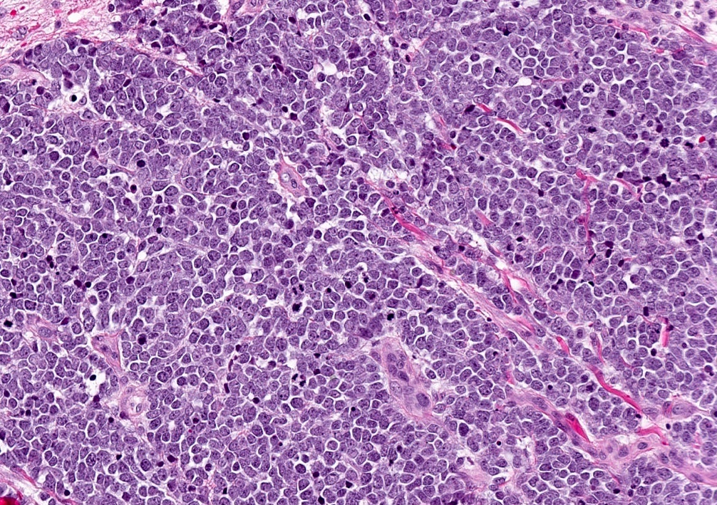 Merkel cells